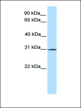 Anti-SURF4 antibody produced in rabbit