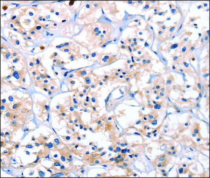 Anti-CATSPER1 antibody produced in rabbit