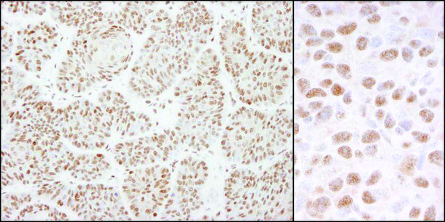 Rabbit anti-DDB1 Antibody, Affinity Purified