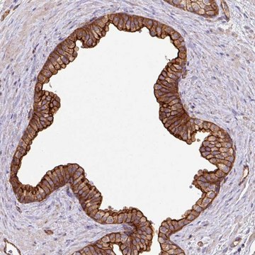 Anti-LRRC53 antibody produced in rabbit