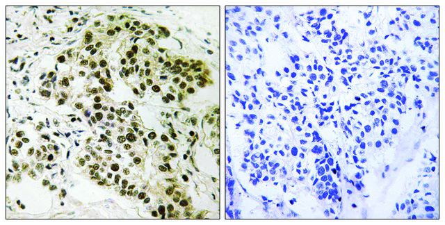 Anti-Retinoblastoma antibody produced in rabbit