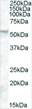 Anti-FKBP4/FKBP52 antibody produced in goat