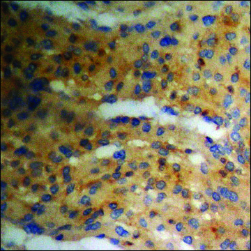 Anti-phospho-PKA CAT (pThr¹??) antibody produced