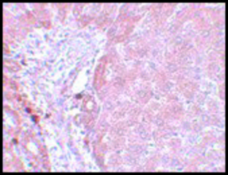 Anti-LYRM3 antibody produced in rabbit