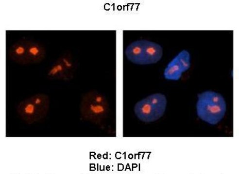 Anti-C1ORF77 antibody produced in rabbit