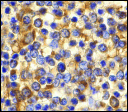 Anti-CCR3 antibody produced in rabbit