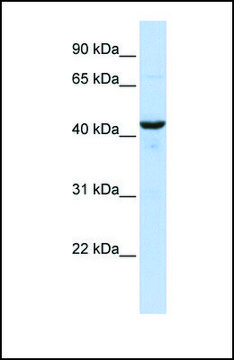 Anti-RNH1 antibody produced in rabbit