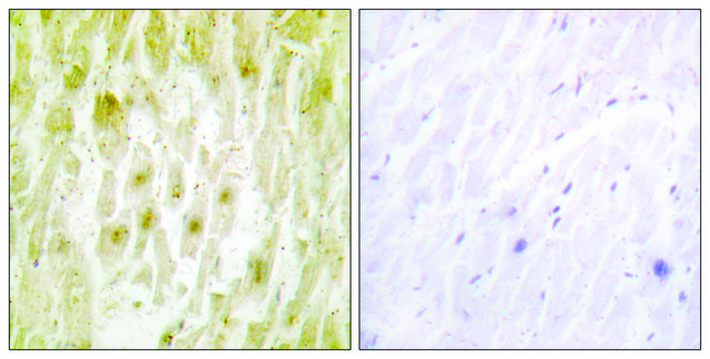 Anti-TF2E2 antibody produced in rabbit