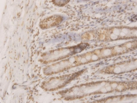 Monoclonal Anti-WDR58 antibody produced in