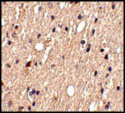 Anti-Spred1 (ab1) antibody produced in