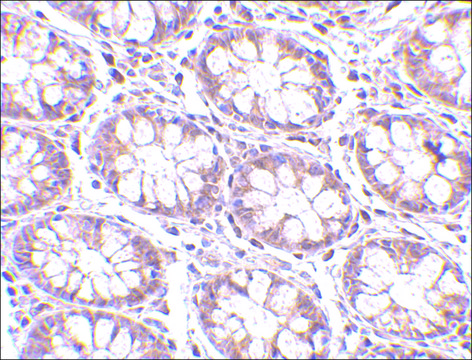 Anti-STEAP2 antibody produced in rabbit