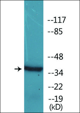 Anti-phospho-C/EBP-? (pThr²²?) antibody produced in