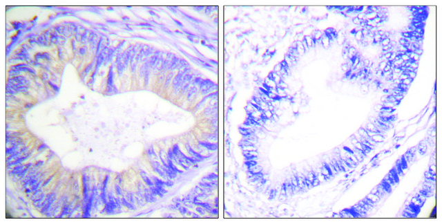 Anti-CBL antibody produced in rabbit