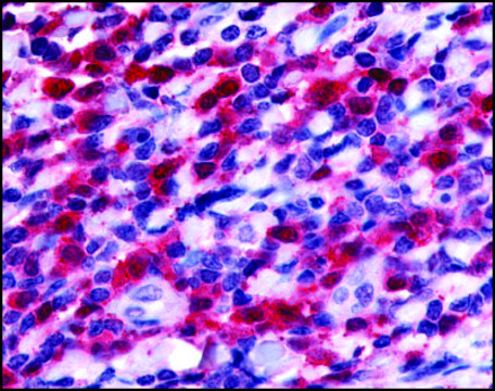 Anti-FLT3 antibody produced in rabbit