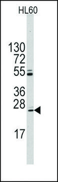 Anti-UBTD1 (C-term Q173) antibody produced