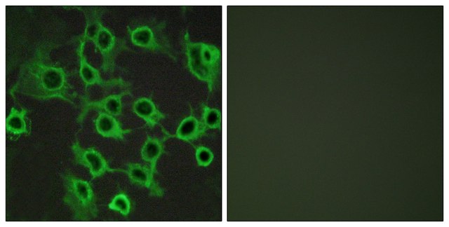 Anti-CCRL2 antibody produced in rabbit