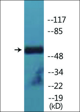 Anti-phospho-Lck (pTyr???) antibody produced in