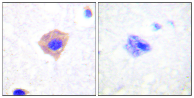 Anti-Catalase antibody produced in rabbit