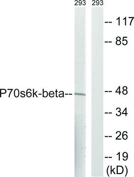 Anti-p70 S6 Kinase ?, C-Terminal