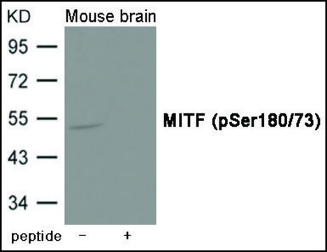 Anti-phospho-MITF (pSer180/73) antibody produced in