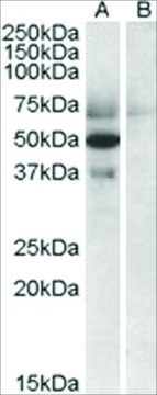 Anti-Apolipoprotein L4 antibody produced in