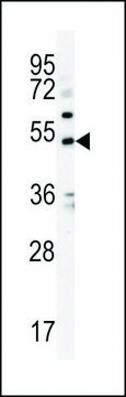ANTI-KCNJ6 (CENTER) antibody produced in