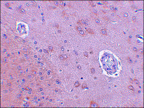 Anti-FAM120A antibody produced in rabbit