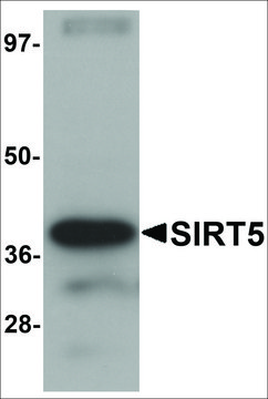 Anti-SIRT5 antibody produced in chicken