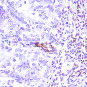 Anti-FBXW7 antibody, Rabbit monoclonal