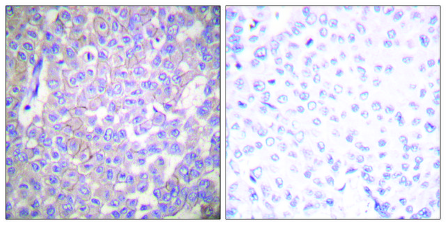 Anti-Claudin 2 antibody produced in