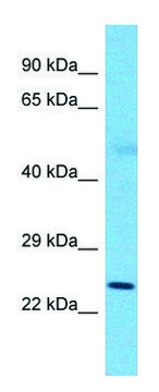 Anti-SLC25A26 (N-terminal) antibody produced in