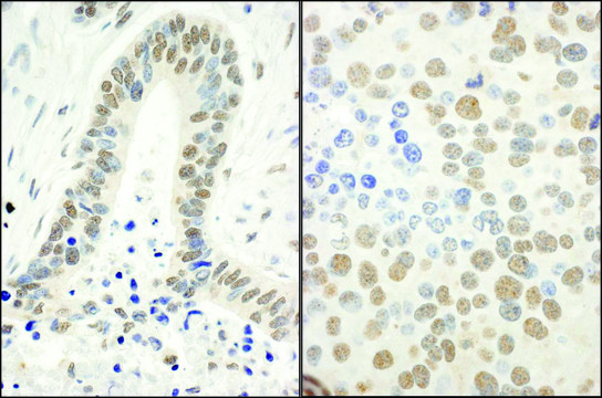Rabbit anti-Phospho RPA32 (S4/S8) Antibody,