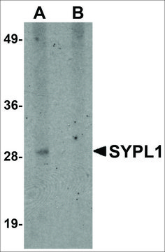 Anti-SYPL1 antibody produced in rabbit