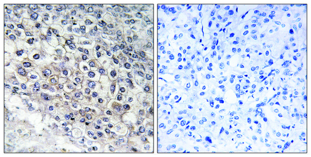 Anti-Cytochrome P450 2W1 antibody produced