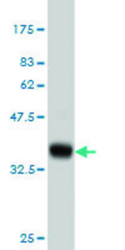ANTI-CACNB2 antibody produced in mouse