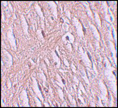 Anti-ZIP9 antibody produced in rabbit