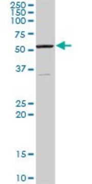 Anti-AAAS antibody produced in rabbit