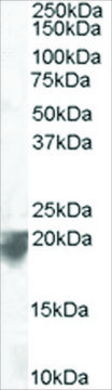 Anti-VPS29, C-Terminal antibody produced in