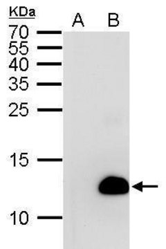 Monoclonal Anti-6X His tag antibody