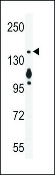 ANTI-MYO6 (C-TERM R1181) antibody produced