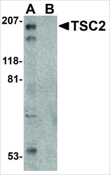 Anti-TSC2 (ab1) antibody produced in
