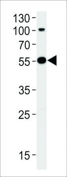 ANTI-PARKIN(N-TERMINAL) antibody produced in rabbit