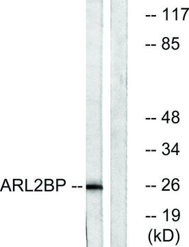 Anti-ARL2BP antibody produced in rabbit