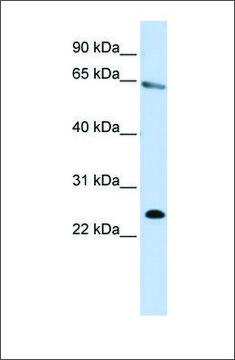 Anti-ZNF326 antibody produced in rabbit
