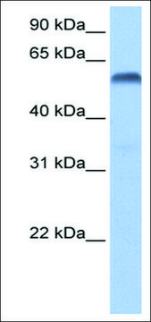 Anti-PAX3 antibody produced in rabbit
