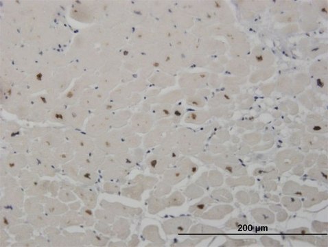 Monoclonal Anti-SALL2 antibody produced in