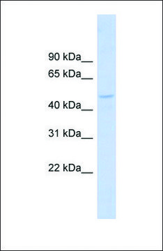 Anti-DBNL antibody produced in rabbit