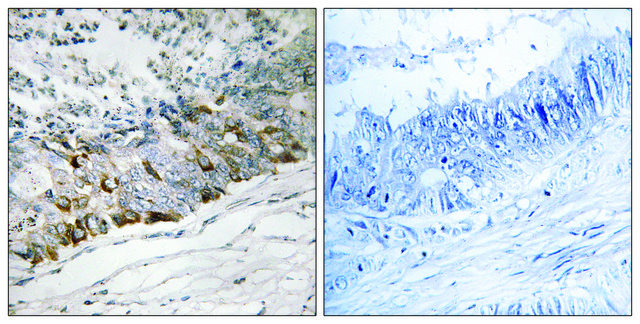 Anti-GCHFR antibody produced in rabbit