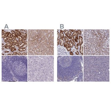 Anti-AK4 antibody produced in rabbit