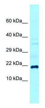 Anti-Grem1 (C-terminal) antibody produced in
